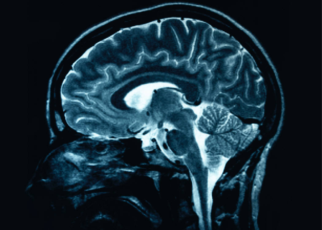 brain_photo_nyreblog_com_.JPG