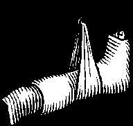 broken_leg_nyreblog.JPG