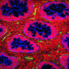 Confocal micrograph shows scattered green areas in red intestinal tissue